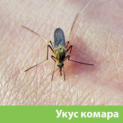 Укусы комаров в Полевском